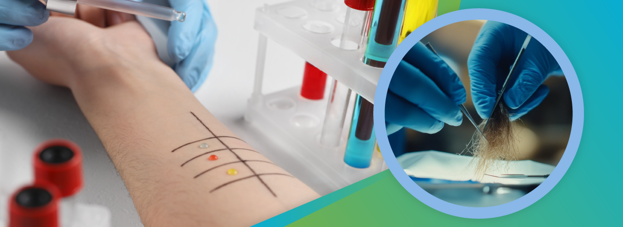 top food intolerance tests